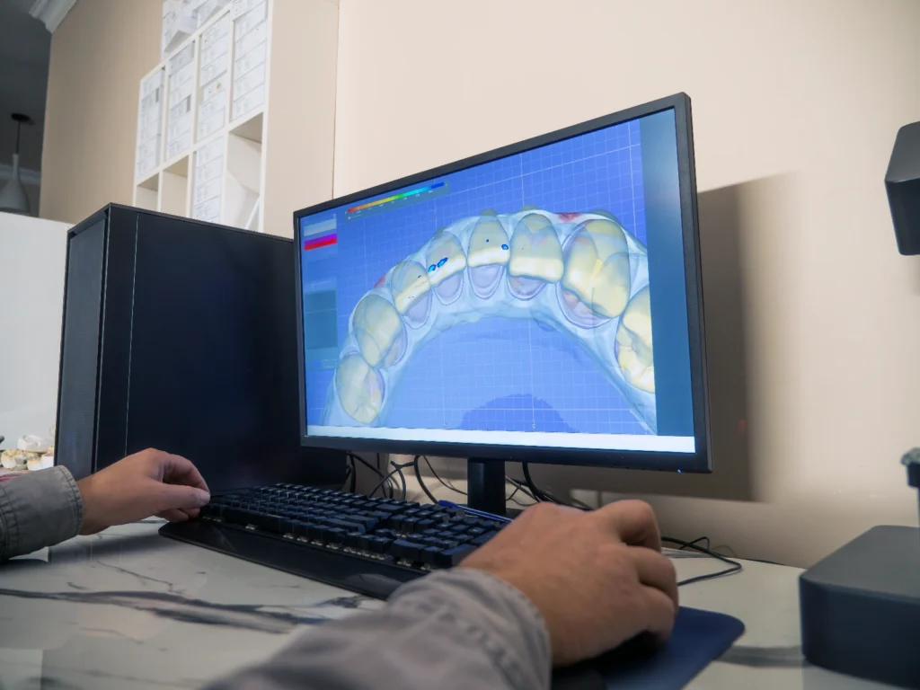 BioEvidens Bio-Ortodonzia trattamento Smile design