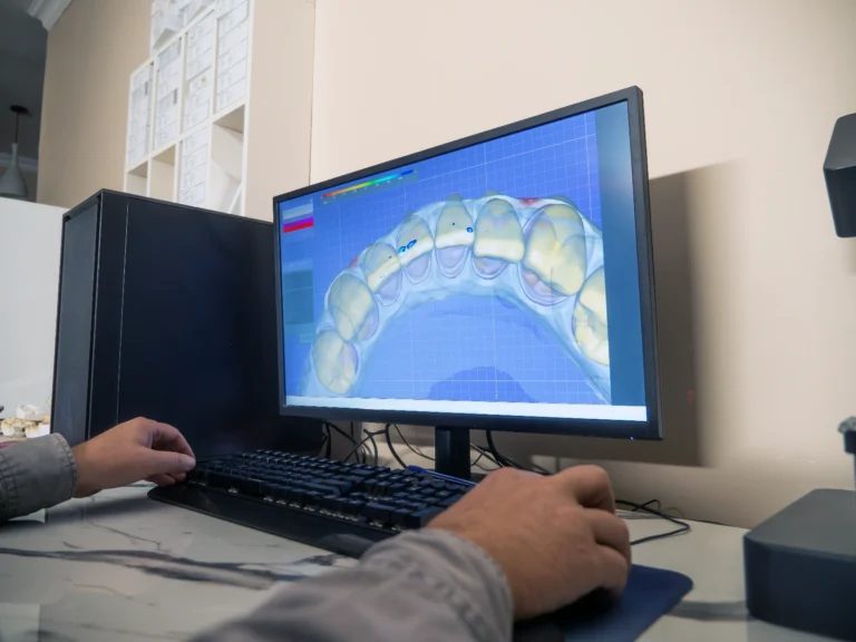 BioEvidens Bio-Ortodonzia trattamento Smile design