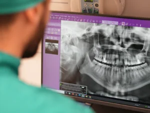 BioEvidens trattamento Agenesie dentali
